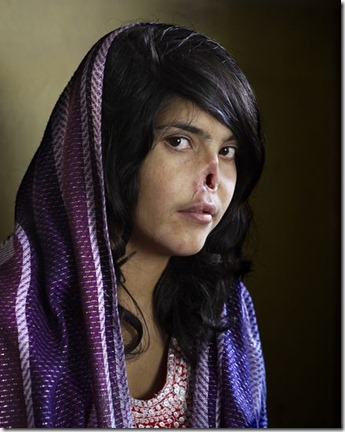 afghanistan kabul girls. an afghan girl mutilated